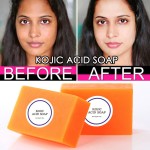 Natural Turmeric Soap Supplier - Private Label Anti Acne Dark Spots Soap
