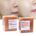 Skin Lightening Soap Factory - OEM Whitening Bleaching Anti Acne Soap Bar