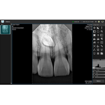 Dental X Ray Machine - Manufacturer - Ray Portable Digital Intraoral Sensor