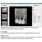Dental X-ray System - Manufacturer - Digital Intra Oral Image Sensors