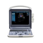 Cardiac Ultrasound Scanner - Manufacturer - 3D 4D Portable Color Doppler Machine