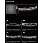 Veterinary Slit Lamp - Manufacturer - Portable Handheld Ophthalmic Vet Equipment