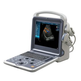 Gynecology Ultrasound Scanner - Manufacturer - Smart Color Doppler Clinic Use