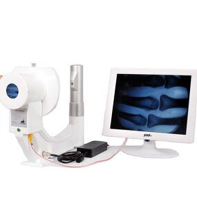 Portable Xray Fluoroscope - Manufacturer - MSLPX37 Perspective Apparatus Machine