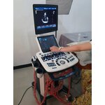 Color Doppler Ultrasound - Manufacturer - MSLCU46 Double Screen Trolley System