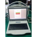 Ultrasound Bone Densitometer - Manufacturer - Automatic Portable Color Diagnostic