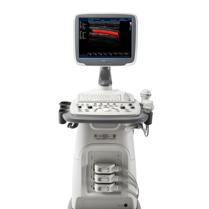 Trolley Ultrasound System - Manufacturer - S11 15 Inch LCD 3D 4D Color Doppler