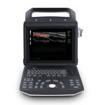 Veterinary Ultrasound Machine - Manufacturer - MSLCU45 Laptop Color Doppler Human/Vet
