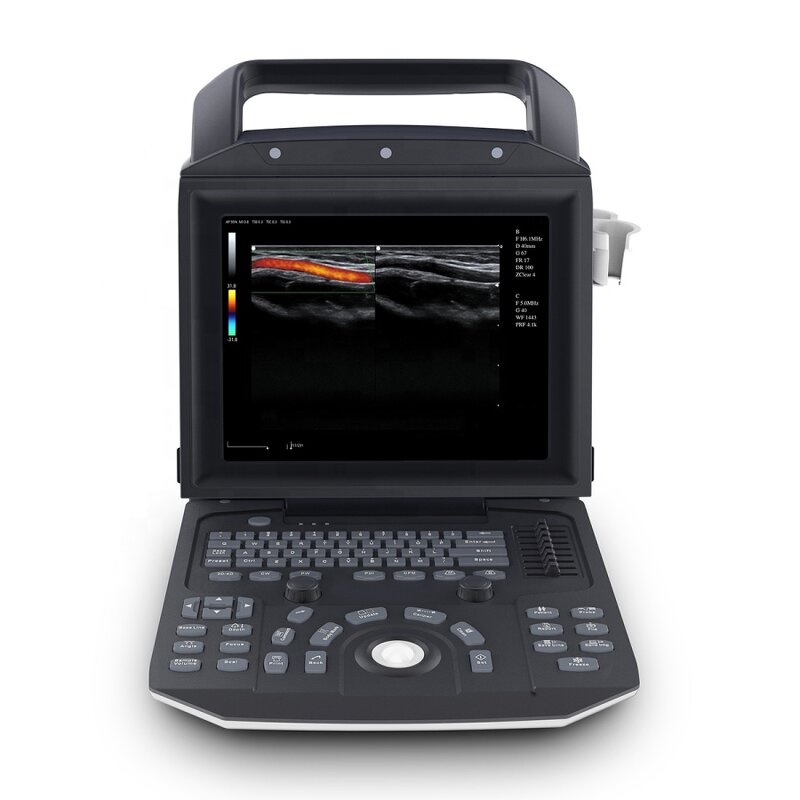 Portable Color Doppler - Manufacturer - 2021 New MSLCU45 Full Digital Ultrasound