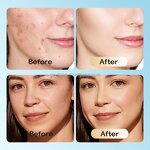 Rosehip Oil Manufacturer - 100% Pure Cold Pressed Moisturizing for All Skin Types Soothing