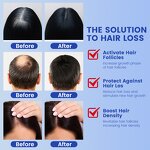 Hair Serum Spray Manufacturer - Private Label Ghk-cu Ahk-cu Copper Peptide Reverse Hair Loss