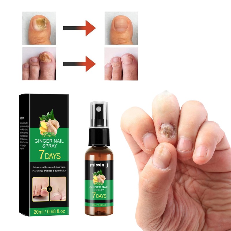 Herbal Nail Treatment Manufacturer - 7 Days Ginger Extract Liquid