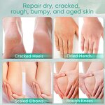 Urea Cream Manufacturer - Hydrate Dry Cracked Heels Feet Knees Elbows Hands