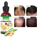 Hair Growth Oil - Manufacturer - Wholesale - Angelica Biotin Ginseng - Roll-on Formula - Hair Regrowth