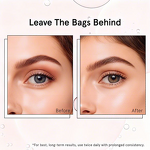 Under Eye Serum Manufacturer - Private Label Caffeine Retinol for Puffy Eye Bags Fine Lines with Eye Roller