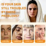 Cleansing Pads Manufacturer - Customized Own Brand Facial Exfoliation Whitening Turmeric Kojic Acid 30 Tablets