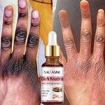 Hand and Body Lotion Manufacturer - Private Label Black Skin Honey Peeling Lightening Whitening Exfoliating for Dark Knuckles