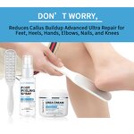 Foot Cream and Spray Manufacturer - Private Label 2% Salicylic Acid 40% Urea for Cracked Heels Dead Skin Removal