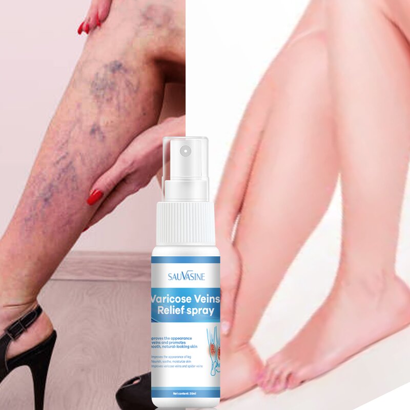 Varicose Veins Spray Manufacturer - Wholesale Hand & Foot Care Relief Spray
