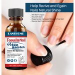 Nail Fungus Removal Gel Manufacturer - Feet Care for Toe Nail Fungus Anti Infection Paronychia Onychomycosis