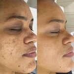 Soap Manufacturer - 100% Natural Organic OEM Whitening Kojic Acid Turmeric for All Skin Types