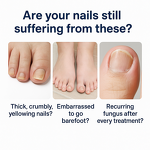 Nail Treatment Pen Manufacturer - Private Label Anti Fungal Repair for Finger Toe Care Nail Fungus Liquid