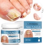 Nail Fungus Removal Cream Manufacturer - Lanthome Onychomycosis Fungal Treatment Paronychia Anti Infection Feet Toe Care