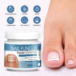 Nail Fungus Removal Cream Manufacturer - Lanthome Onychomycosis Fungal Treatment Paronychia Anti Infection Feet Toe Care