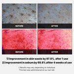 Facial Peeling Pads Manufacturer - Customized Logo Red Succinic Acid Panthenol for Exfoliating Breakout-Prone Skin