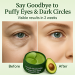 Eye Bag Mask Manufacturer - OEM Organic Nature Avocado Moisturizing Collagen for Hydrating and Soothing