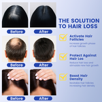 Hair Serum Manufacturer - OEM ODM Scalp Nourishing Multi Peptide for Thinning Hair Density