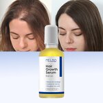 Hair Growth Serum Manufacturer - Private Label Roll on Hydrating Healthy Rosemary for Scalp