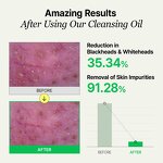 Tea Tree Essential Oil - Wholesale Bulk 1KG Best Price Factory Supply