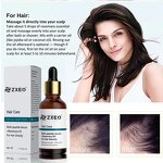 Rosemary Hair Oil - New Product for Thin Skin Healthy Scalp Hair Growth