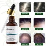Rosemary Hair Oil - New Product for Thin Skin Healthy Scalp Hair Growth