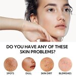 Lychee Soap Manufacturer - Customized Whitening Skin Lightening Handcrafted 14pcs Face Body Bathing