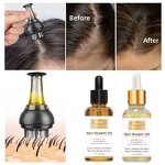 Scalp Massager Comb Manufacturer - Scalp Massager With Oil Anti-hair Loss Liquid Guide Massage Comb