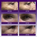 Eye Cream Manufacturer - Vibration Massager Collagen - Deep Hydration Anti Wrinkle Eye Care Private Label