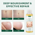 Stretch Mark Oil Manufacturer - Postpartum Repair Massage Oil - Scar Removal Body Moisturizing Treatment