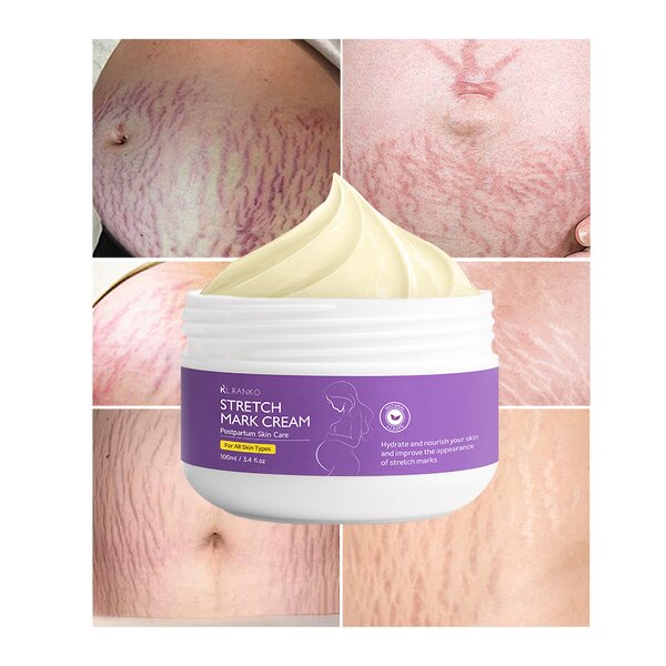 Stretch Mark Cream Manufacturer - Strong Scar Removal - Pregnancy Skin Repair Treatment OEM Private Label