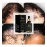 Beard Growth Oil Manufacturer - Biotin Rosemary Ginger Serum - Men Hair Loss Regrowth Private Label