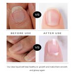 Nail Care Pen Manufacturer - Castor Oil Aloe Vera - Strengthening Growth Weak Nails Private Label