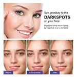 Brightening Face Cream Manufacturer - Kojic Acid Dark Spot Corrector - Whitening Skin Tone Correcting Private Label