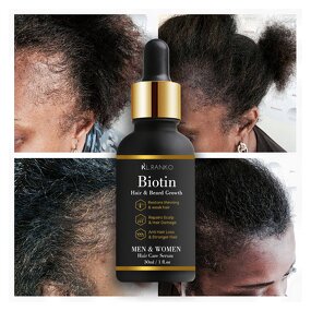 Beard Growth Serum Manufacturer - Small Batch Customization - Hair Care Treatment Private Label