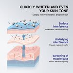 Intimate Whitening Cream Manufacturer - 7 Days Private Parts Whitening - Dark Knuckle Underarm Bikini Lightening OEM