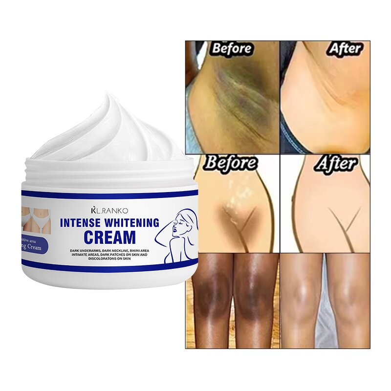 Intimate Whitening Cream Manufacturer - 7 Days Private Parts Whitening - Dark Knuckle Underarm Bikini Lightening OEM