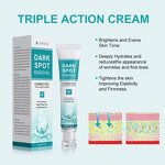 Dark Spot Removal Cream Manufacturer - Kojic Acid Dark Spot Corrector - Freckle Melasma Acne Clear Skin