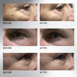 Firming Cream Manufacturer - Peptide Complex Hyaluronic Acid - Wrinkle Reduction Firming Skin Private Label