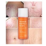 Stretch Mark Oil Manufacturer - 100% Natural Scar Removal - Safe Effective Stretch Mark Treatment Private Label