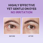 Eye Cream Manufacturer - Retinol Hyaluronic Acid Caffeine - Dark Circle Puffiness Eye Care OEM Private Label